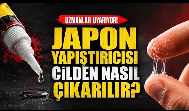 Japon Yapıştırıcısı Cilde Yapışırsa Ne Yapmalı? Uzmanlardan Güvenli Çözüm Önerileri