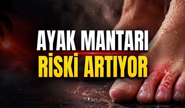 Yazın Ayak Sağlığı Alarm Veriyor: Terleme ve Mantar Riskine Dikkat