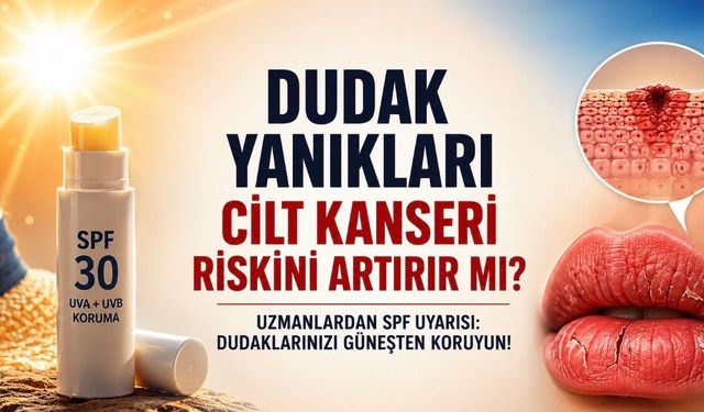 Dudak Yanığı Basit Bir Yaz Sorunu Değil: Uzmanlardan SPF Uyarısı