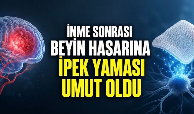İnme Sonrası Beyin Hasarını Onarım İçin İpek Yama Geliştirildi