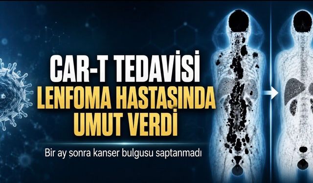 CAR-T Tedavisi Sonrası Lenfoma Hastasında Kanser Bulgusu Kalmadı