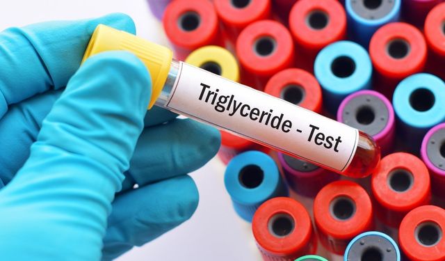 Trigliserit Nasıl Düşürülür? Bilimsel Veriler Etkili Yöntemleri Ortaya Koydu