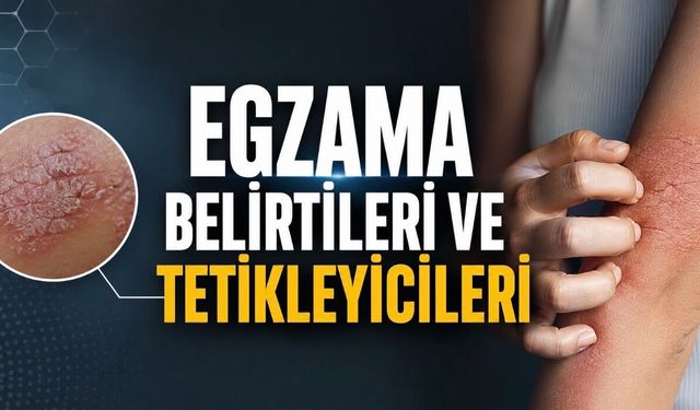 Egzama belirtileri, nedenleri ve tedavisi hakkında bilinmesi gerekenler