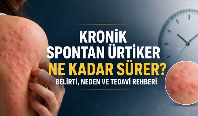 Kronik Spontan Ürtiker Nedir? Belirti, Tedavi ve Yaşam Rehberi