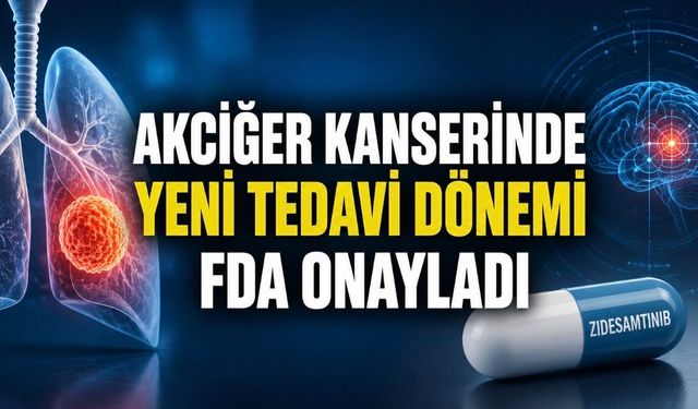 Akciğer Kanserinde Beyin Metastazını Hedefleyen Yeni İlaç Onaylandı
