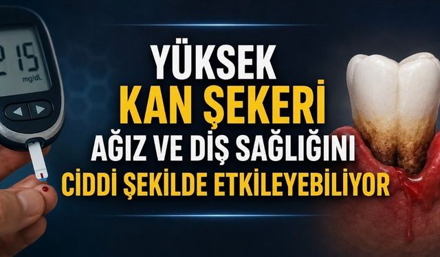 Kontrolsüz Diyabet Ağız Kuruluğu, Diş Eti Hastalığı ve Diş Kaybına Yol Açabiliyor
