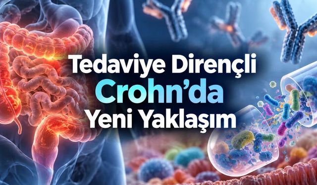 Crohn Hastalığında Gaita Nakli ve Biyolojik Tedavi Birlikte Denendi