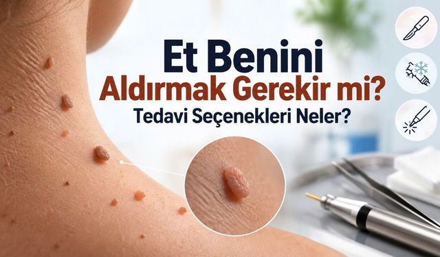 Et Beni Nedir, Neden Çıkar? Et Benleri Hakkında Bilmeniz Gerekenler