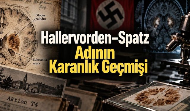 Tıp Bu İki Doktorun Adını Neden Terk Etti? Hallervorden–Spatz Hastalığının Nazi Geçmişi