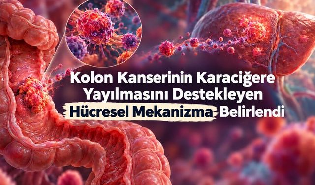 Kolon Kanseri, Yayılmak İçin Bağırsağın Onarım Programını Kullanabiliyor