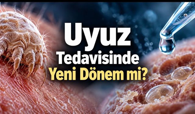 Uyuz paraziti ve yumurtaları deneysel tedaviyle ortadan kaldırıldı