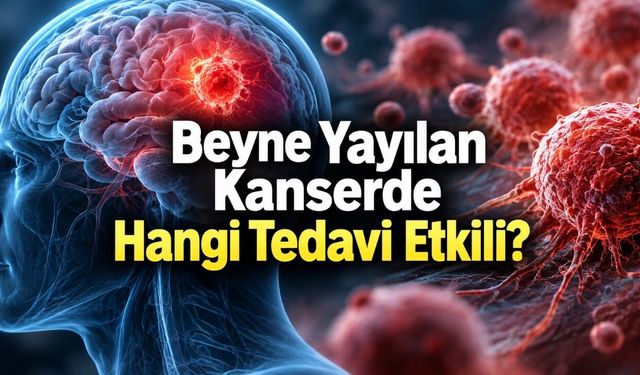 Beyin Metastazında Tedavi Değişiyor: Ameliyat ve Işın Tedavisine Yeni Seçenekler
