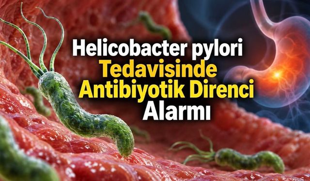 Helicobacter pylori Neden Tedaviye Direnç Gösteriyor? BMJ’den Önemli Değerlendirme