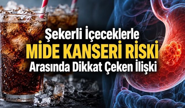 Günde Birden Fazla Şekerli İçecek Tüketenlerde Mide Kanseri Riski 2,45 Kat Yüksek Bulundu