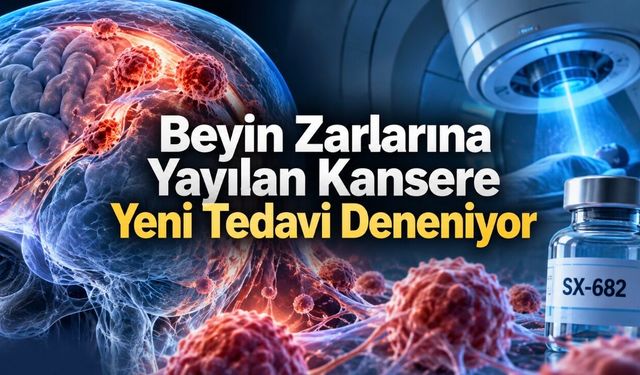 Beyin Zarlarına Yayılan Kansere Karşı Yeni Tedavi İnsanlarda Deneniyor