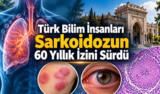 Sağlık Bilimleri Üniversitesi ve Cerrahpaşa'dan 60 Yıllık Sarkoidoz Araştırması: 720 Hasta İncelendi