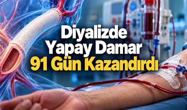 Yapay İnsan Damarı Diyaliz Hastalarında 91 Günlük Avantaj Sağladı