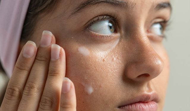 Milia (Milium) Nedir, Teşhis ve Tedavisi Nasıldır?