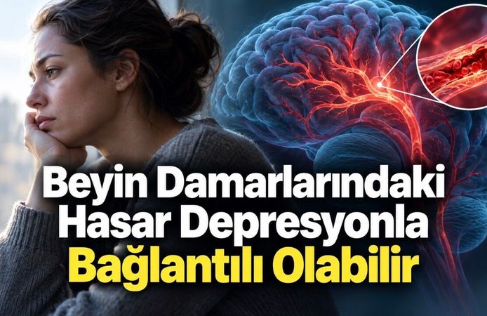 Serebral Küçük Damar Hastalığı ve Depresyon: 40 Bin Kişilik Analiz Ne Gösterdi?