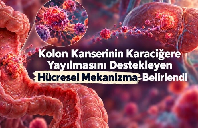 Kolon Kanseri, Yayılmak İçin Bağırsağın Onarım Programını Kullanabiliyor