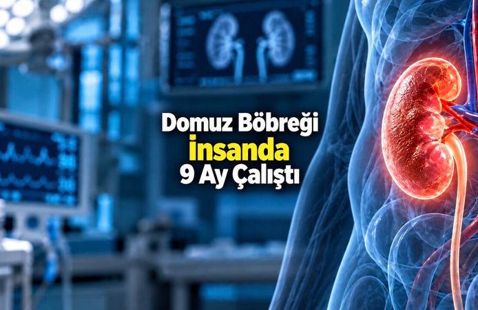 Diyalizin Geleceğini Değiştirebilir: Domuz Böbreği İnsanda 9 Ay İşlev Gördü