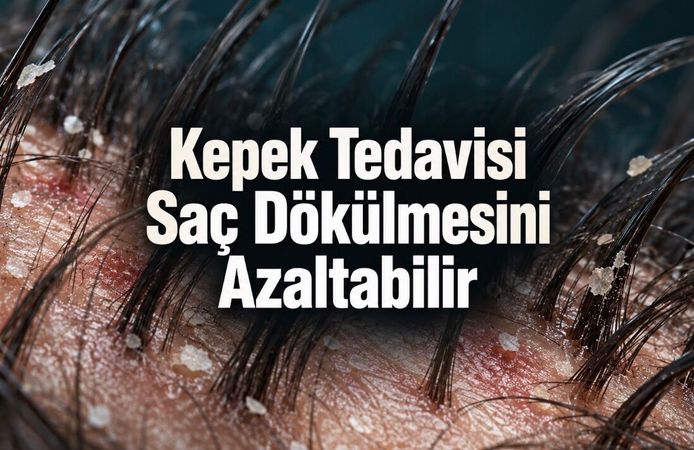 Kepek Tedavisi Saç Dökülmesini Azaltabilir: Ancak Her Dökülme Kepekten Değil
