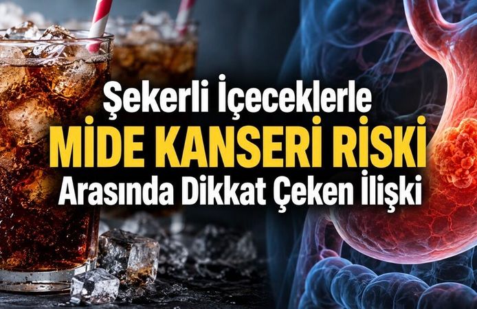 Günde Birden Fazla Şekerli İçecek Tüketenlerde Mide Kanseri Riski 2,45 Kat Yüksek Bulundu