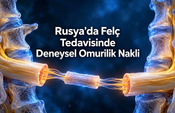 Rusya'da İlk İnsan Omurilik Nakli Yapıldığı Açıklandı