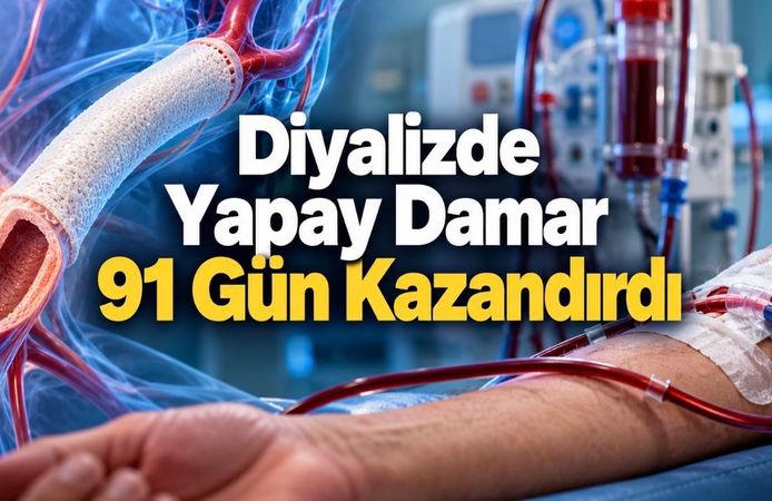 Yapay İnsan Damarı Diyaliz Hastalarında 91 Günlük Avantaj Sağladı