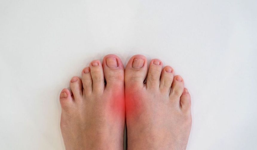 Bir Gecede Gelen Şiddetli Ağrı: Gut Hastalığı Artık Sadece “Zengin Hastalığı” Değil