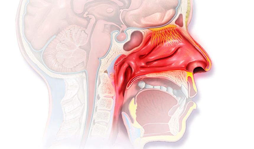 Yeni Klinik Rehber, Alerjik ve Alerjik Olmayan Rinitte Tanı ve Tedaviyi Yeniden Tanımladı