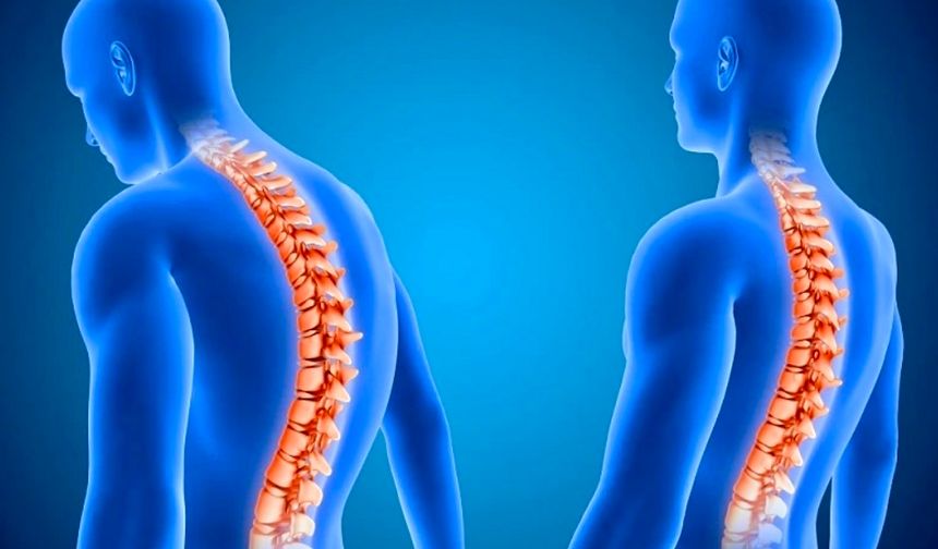 Uzmanlar Uyardı: Telefona Bağlı Sırt Kamburlaşması Çoğu Kişide Düzelebiliyor