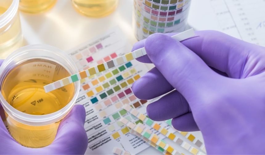 İdrarda protein kaçağı neden olur, her zaman böbrek hastalığı mı?