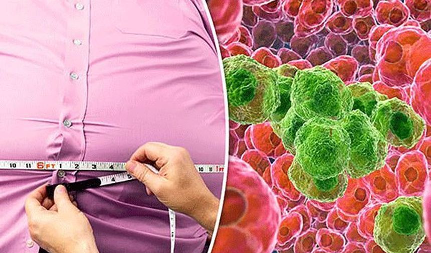 Obezite Enfeksiyon Ölümlerini Yüzde 70 Artırıyor