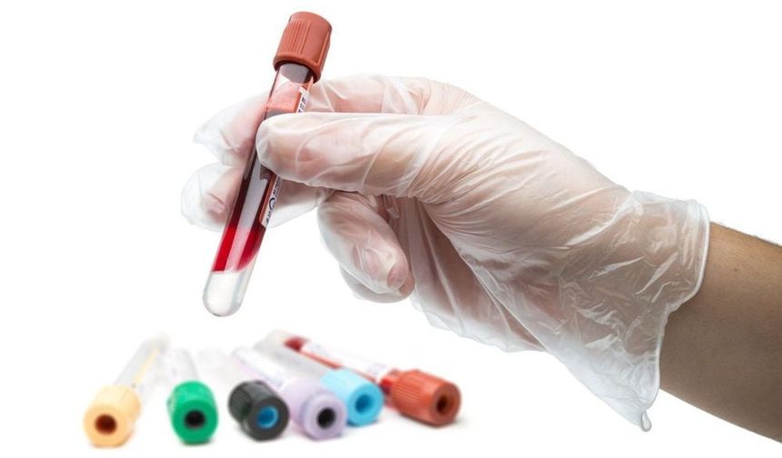 Hangi Tümör Belirteci Hangi Kanserde Kullanılır? En Çok Merak Edilenler