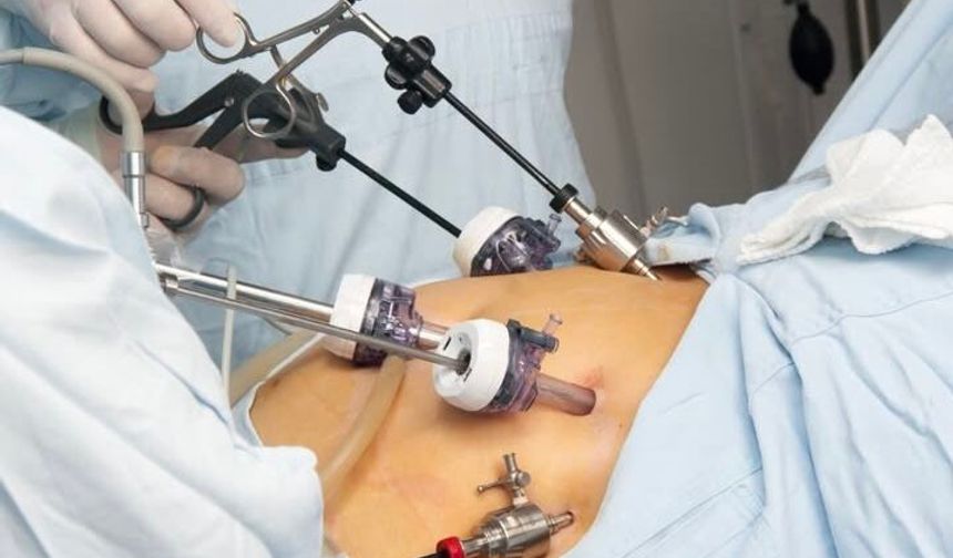 Diyabet Hastaları İçin Çarpıcı Sonuç: Ameliyat mı, Zayıflama İğnesi mi?