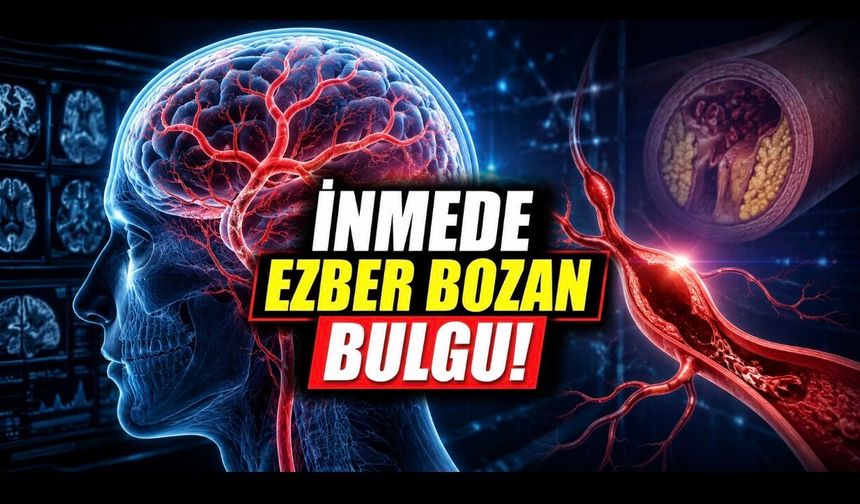 Beyin Damarlarında Ezber Bozan Bulgular: İnmede Tıkanıklık Değil Genişleme Öne Çıktı