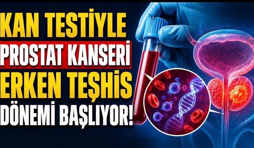 Kan Testiyle Prostat Kanseri Teşhisinde Yeni Umut: Sıvı Biyopsi Dönemi Yakın