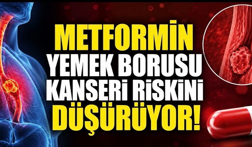 Metformin Kullananlarda Yemek Borusu Kanseri Riski Daha Düşük Bulundu