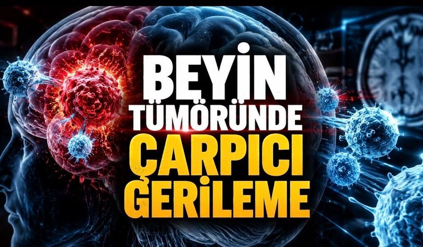 Deneysel CAR-T Tedavisi Beyin Tümöründe Günler İçinde Küçülme Sağladı