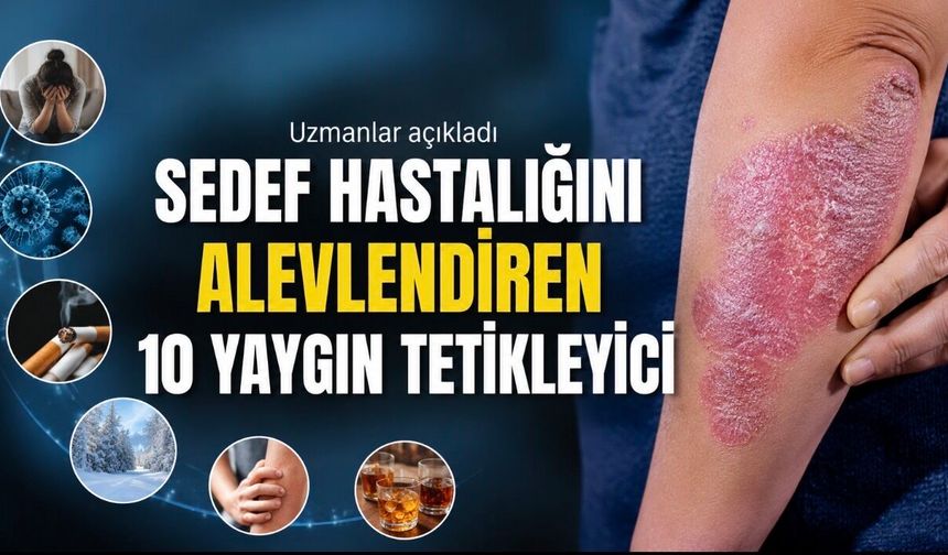 Sedef Hastalığını Alevlendiren 10 Yaygın Tetikleyici