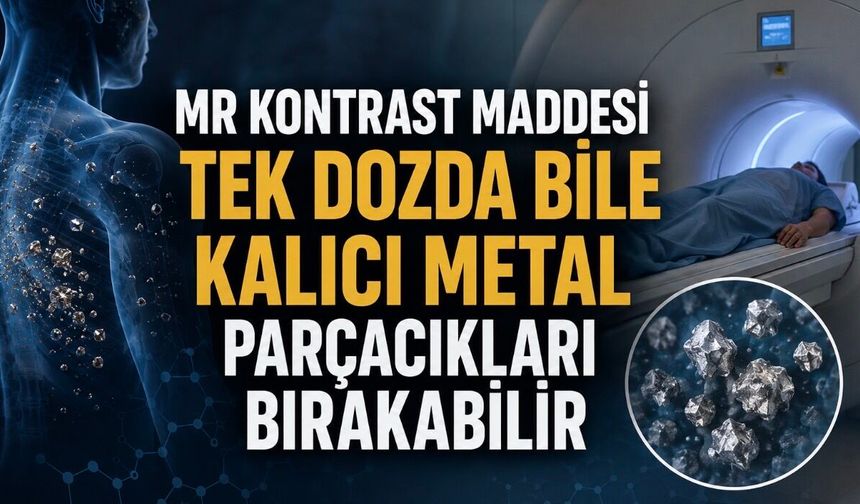 MR Kontrast Maddesi Tek Dozda Bile Kalıcı Metal Parçacıkları Bırakabilir
