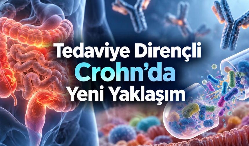 Crohn Hastalığında Gaita Nakli ve Biyolojik Tedavi Birlikte Denendi