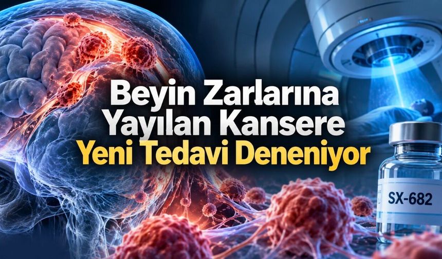 Beyin Zarlarına Yayılan Kansere Karşı Yeni Tedavi İnsanlarda Deneniyor
