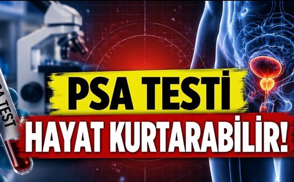 PSA Testi Tartışmasında Yeni Dönem: Prostat Kanseri Ölümlerini Azaltabilir