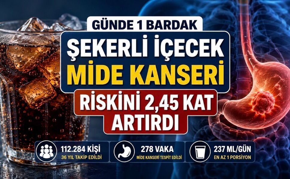 Her Gün Şekerli İçecek Tüketenlerde Mide Kanseri Riski 2,45 Kat Yüksek