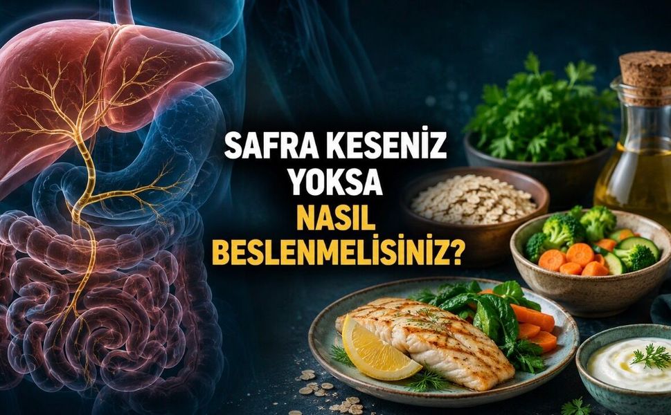 Safra Keseniz Yoksa Beslenmede Nelere Dikkat Etmelisiniz?