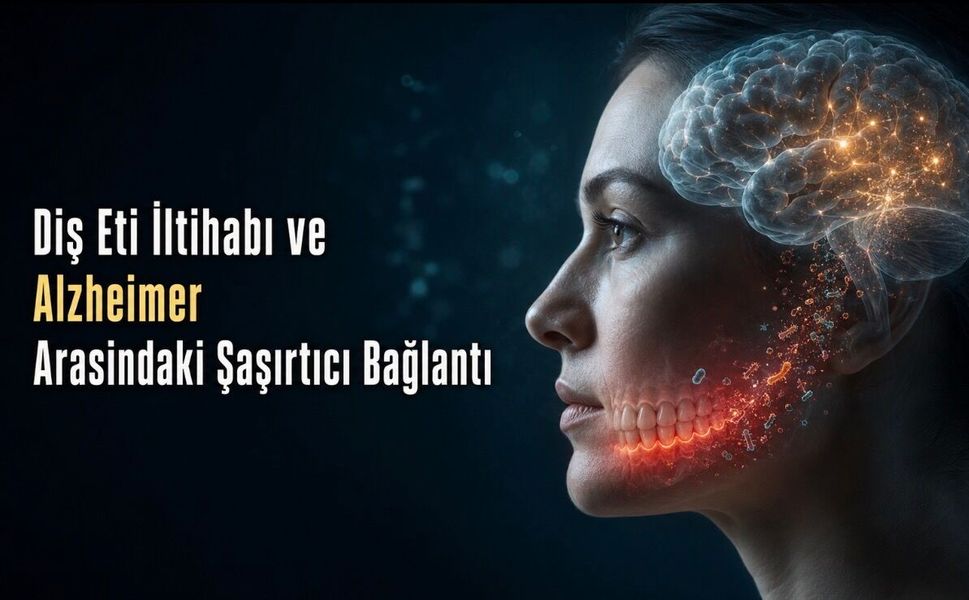 Kanayan Diş Etleri ile Alzheimer Arasında Nasıl Bir Bağ Var?