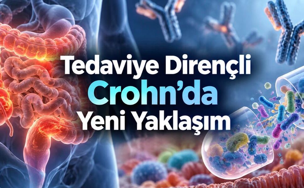 Crohn Hastalığında Gaita Nakli ve Biyolojik Tedavi Birlikte Denendi