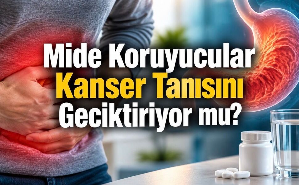 Mide Koruyucular Mide Kanseri Tanısını Geciktiriyor mu? 21 Bin Hastalık Çalışmanın Sonucu